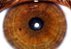 oeil4_b